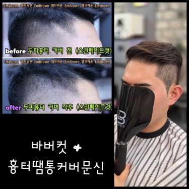 바버컷 & 두피흉터(땜통)문신