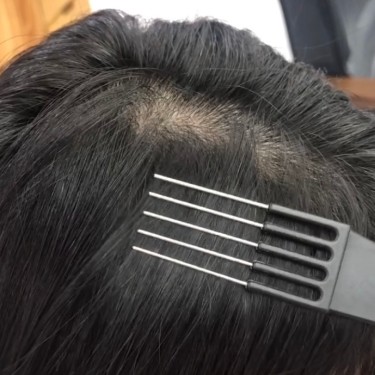 뿌리펌 [ 뿌리매직x ]