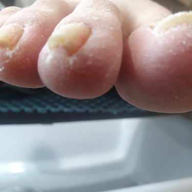 발각질스페셜(개인파일사용)