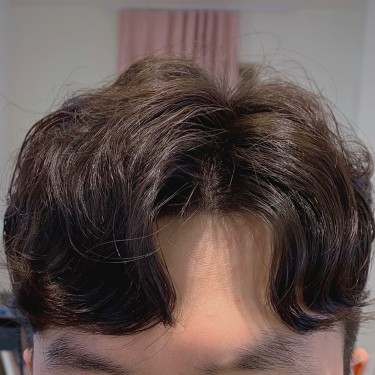 MAN)남성컷+리커버리두피스파