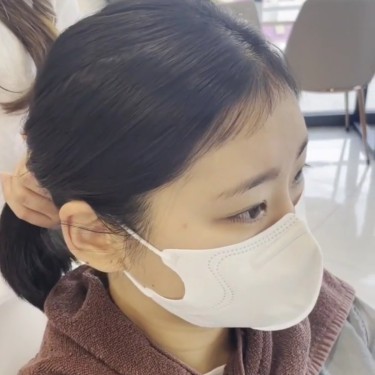 얼굴소멸잔머리컷+펌 시술 패키지