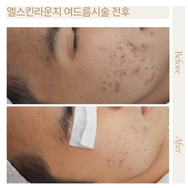 데일리케어 맞춤케어