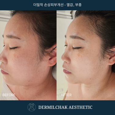 세포성장단계 - 하이드라워터