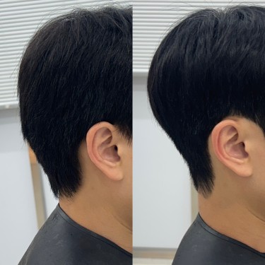 탈모 고민 두피케어컷