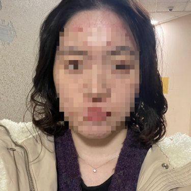 포토리뷰 1