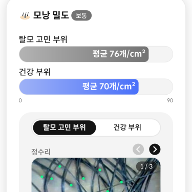 포토리뷰 5